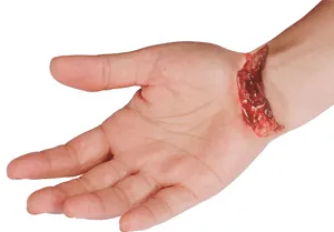 Traumatic Reconstruction